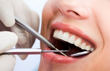 Diş Tedavisi İçin Neden Türkiye'yi Düşünmelisiniz?